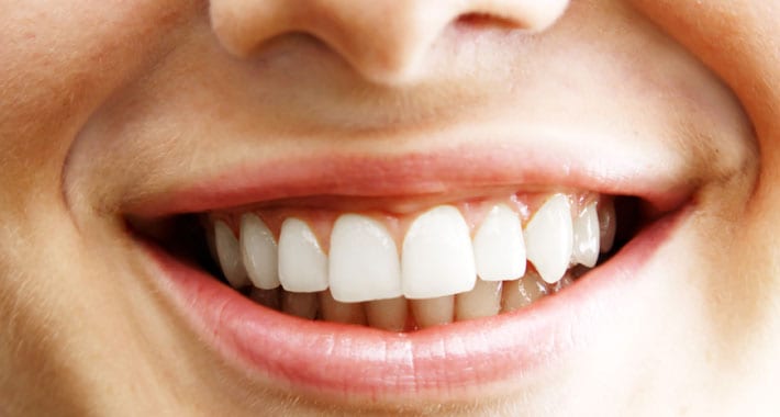 Charles Keasing Stemmen behandeling Teruggetrokken tandvlees herstellen – 5 tips tegen terugtrekkend tandvlees  - Gezondr.nl