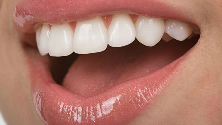 Tandvleesontsteking tips ter behandeling van gingivitis - Gezondr.nl