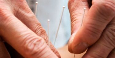 Acupunctuur + afvallen: waarom het wel & niet werkt
