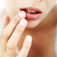 droge-lippen-oorzaken-tips