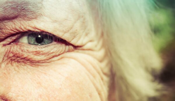 oudere-vrouw-oma-ogen-oogleden